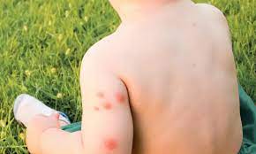 Mamaearth Anti Mosquito Fabric Roll On: Protect Your Little Ones from Mosquito Bites
