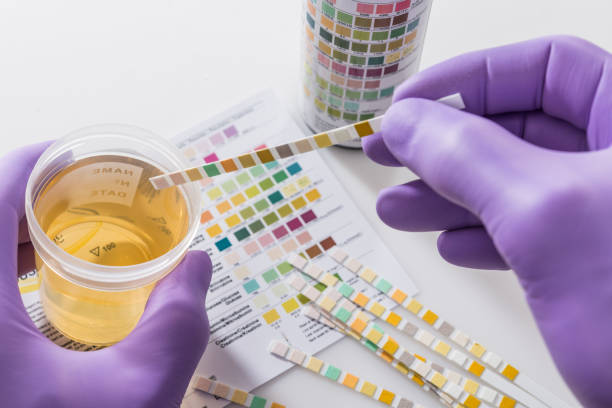 Alkaline vs. Acidic pH in Urine: Effects on UTI Susceptibility