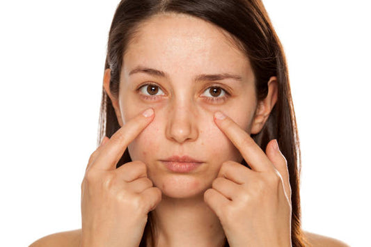 Mamaearth Mamaearth Bye Bye Dark Circles: An Effective Solution for Brighter Under-EyesBye Bye Dark Circles: An Effective Solution for Brighter Under-Eyes