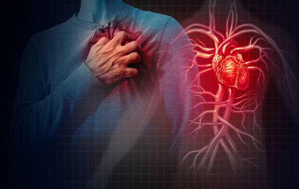  Unlocking the Genetic Connection to Heart Attacks: Understanding Risk Factors