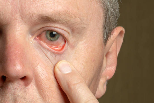 Everfresh Tears Eye Drops: Your Comprehensive Eye Care Solution