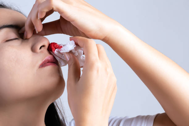 Nosebleed: Causes, Symptoms, and Home Remedies