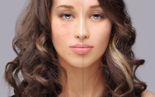 Neutrogena Combi Skin Moisture: Your Skin's Perfect Balance