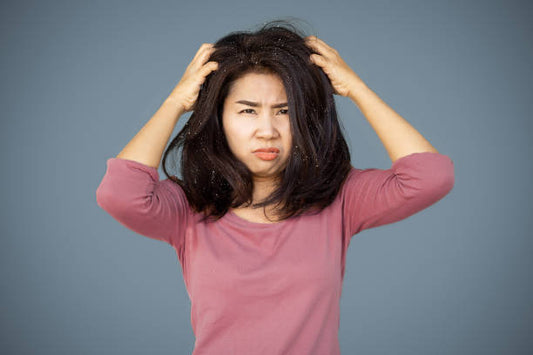 Say Goodbye to Dandruff with Ketokem Shampoo