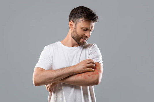 Clocip KZ Soap: The Ultimate Solution for Fungal Skin Infections