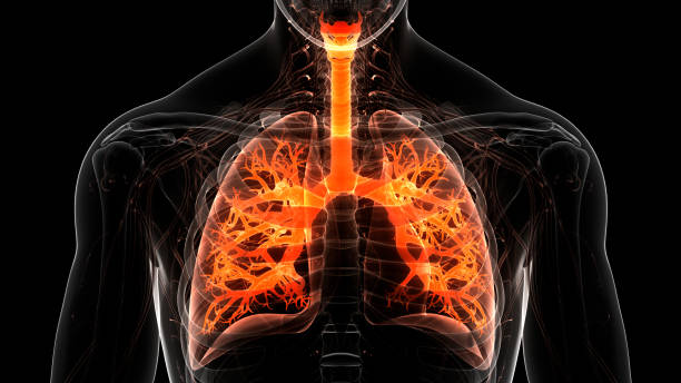 An Overview of Bronchitis: Understanding the Basics – Caresupp.in