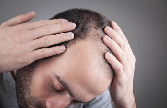 RETRO 5% Solution Spray: Revitalize Your Hair with Effective Hair Regrowth Treatment
