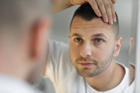 Hair 4U F Minoxidil 5%: An Effective Solution for Hair Regrowth in Men