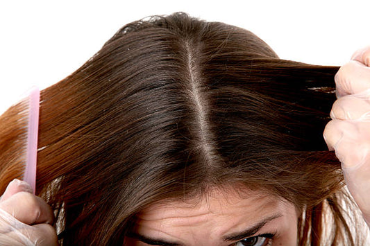 Scalpe Plus Anti-Dandruff Shampoo: Bid Farewell to Dandruff Woes
