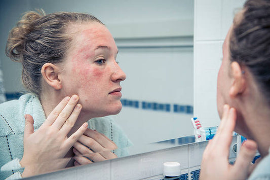 Navigating Sensitive Skin: Understanding Triggers, Care Tips, and Product Choices