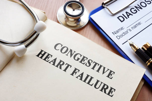 Congestive Heart Failure: Causes, Symptoms, Treatment, and Prevention